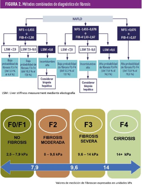 Cómo abordar la esteatosis hepática en el paciente con DM2 Revista