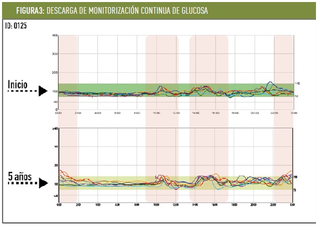 niveles de glucosa