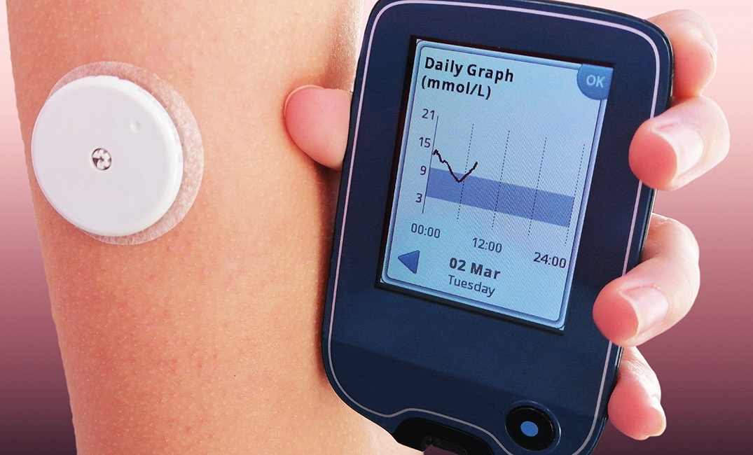 Novedades en sistemas de monitorización continua de glucosa